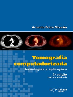cover image of Tomografia computadorizada